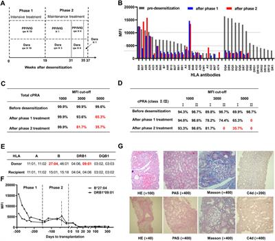 A Novel Daratumumab-Based Regimen for Desensitization in Highly HLA-Presensitized Patients Awaiting Kidney Transplantation
